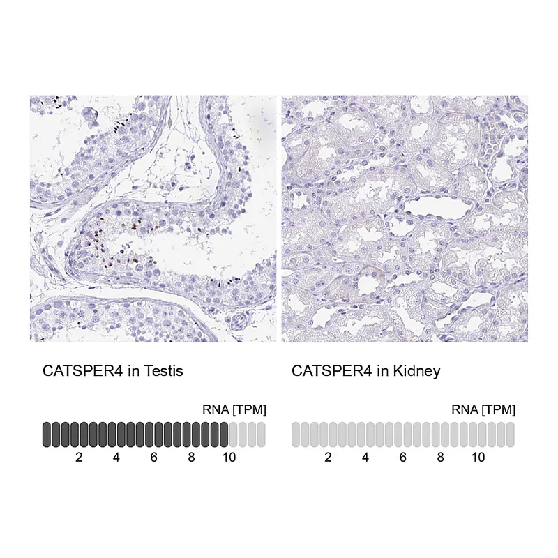 Atlas Antibodies Anti-CATSPER4 Antibody