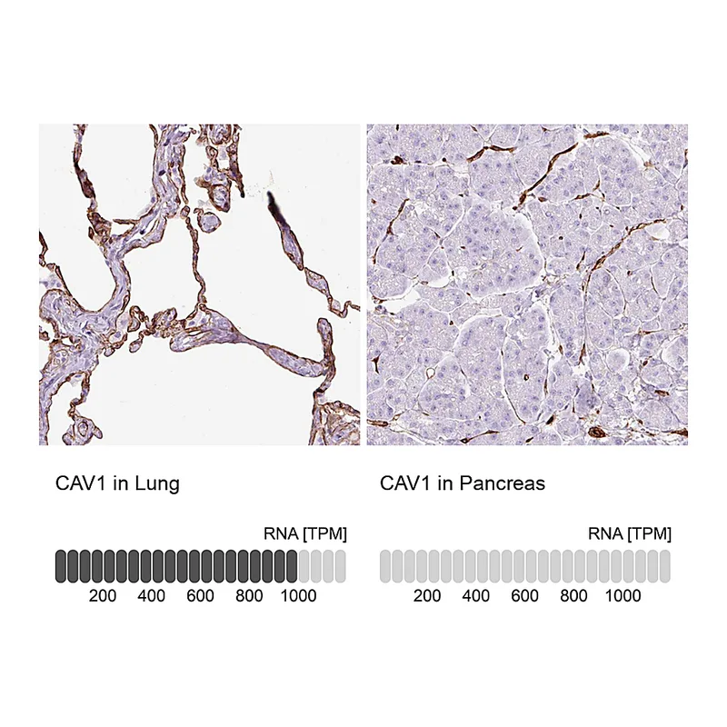 Atlas Antibodies Anti-CAV1 Antibody