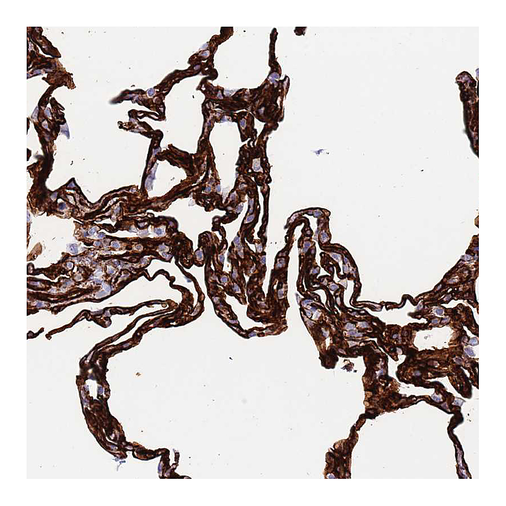 Atlas Antibodies Anti-CAV2 Antibody