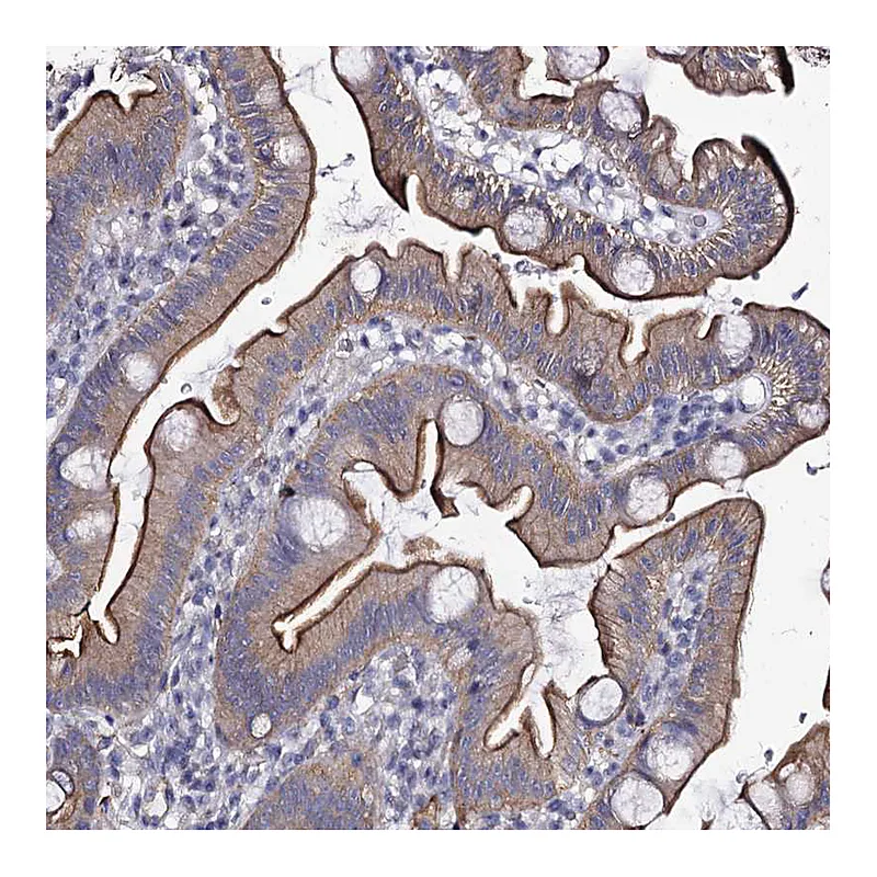 Atlas Antibodies Anti-CBFB Antibody
