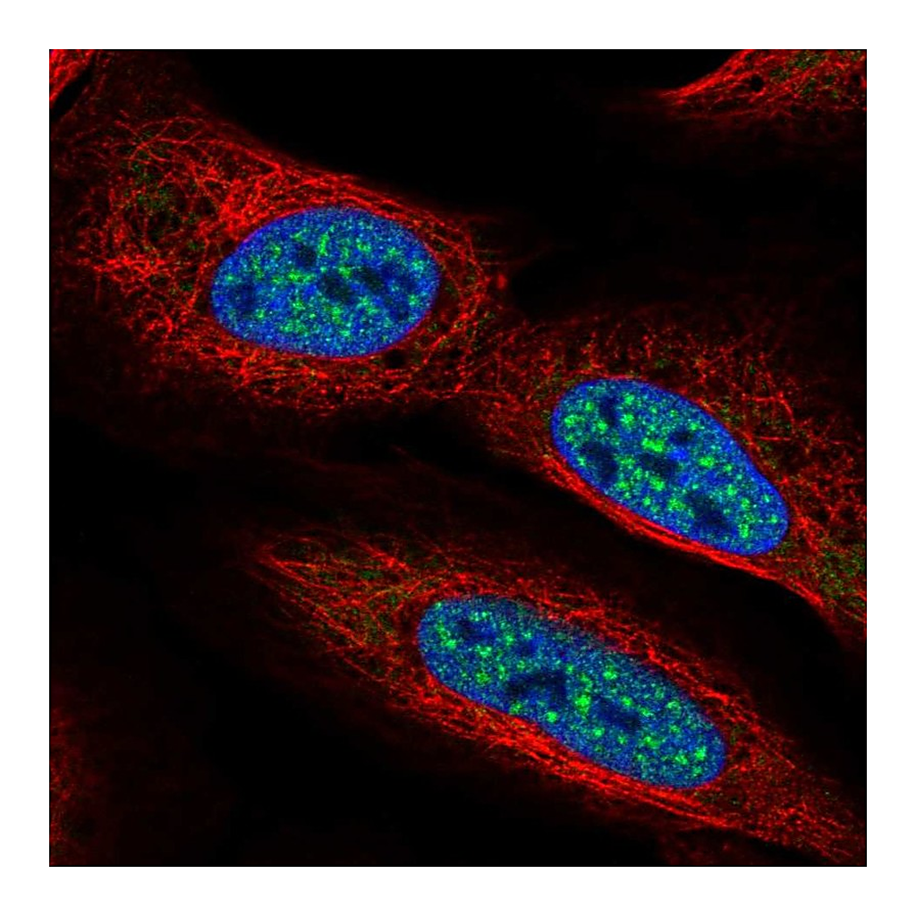 Atlas Antibodies Anti-CBFA2T2 Antibody