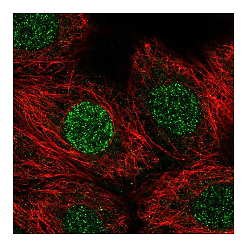 Atlas Antibodies Anti-CBFA2T3 Antibody