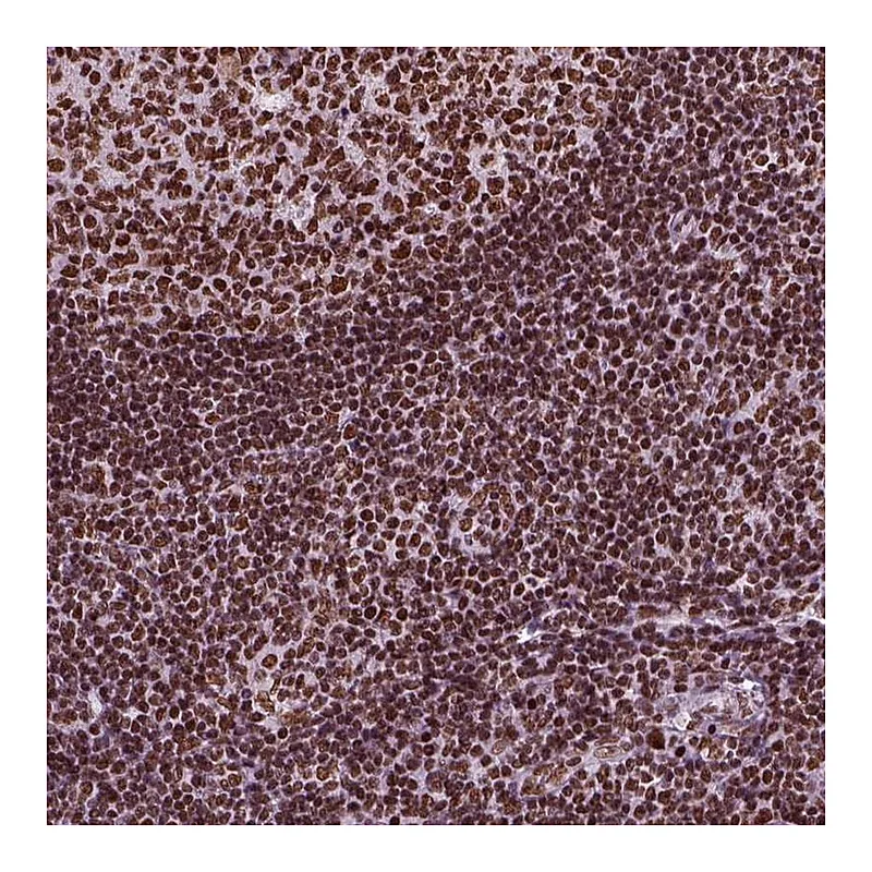 Atlas Antibodies Anti-CBFA2T3 Antibody