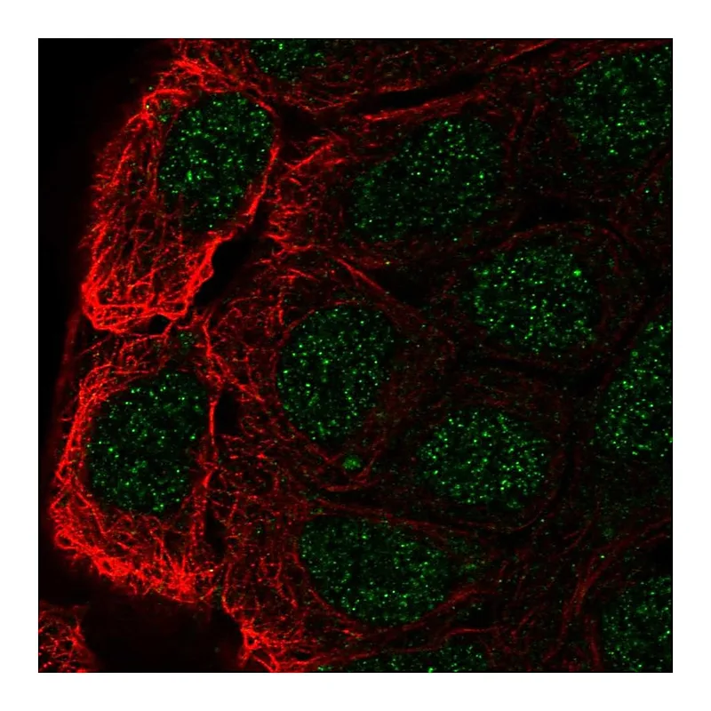 Atlas Antibodies Anti-CBLC Antibody