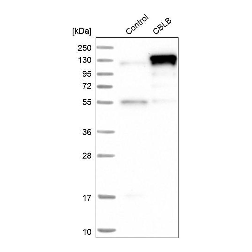 Atlas Antibodies Anti-CBLB Antibody