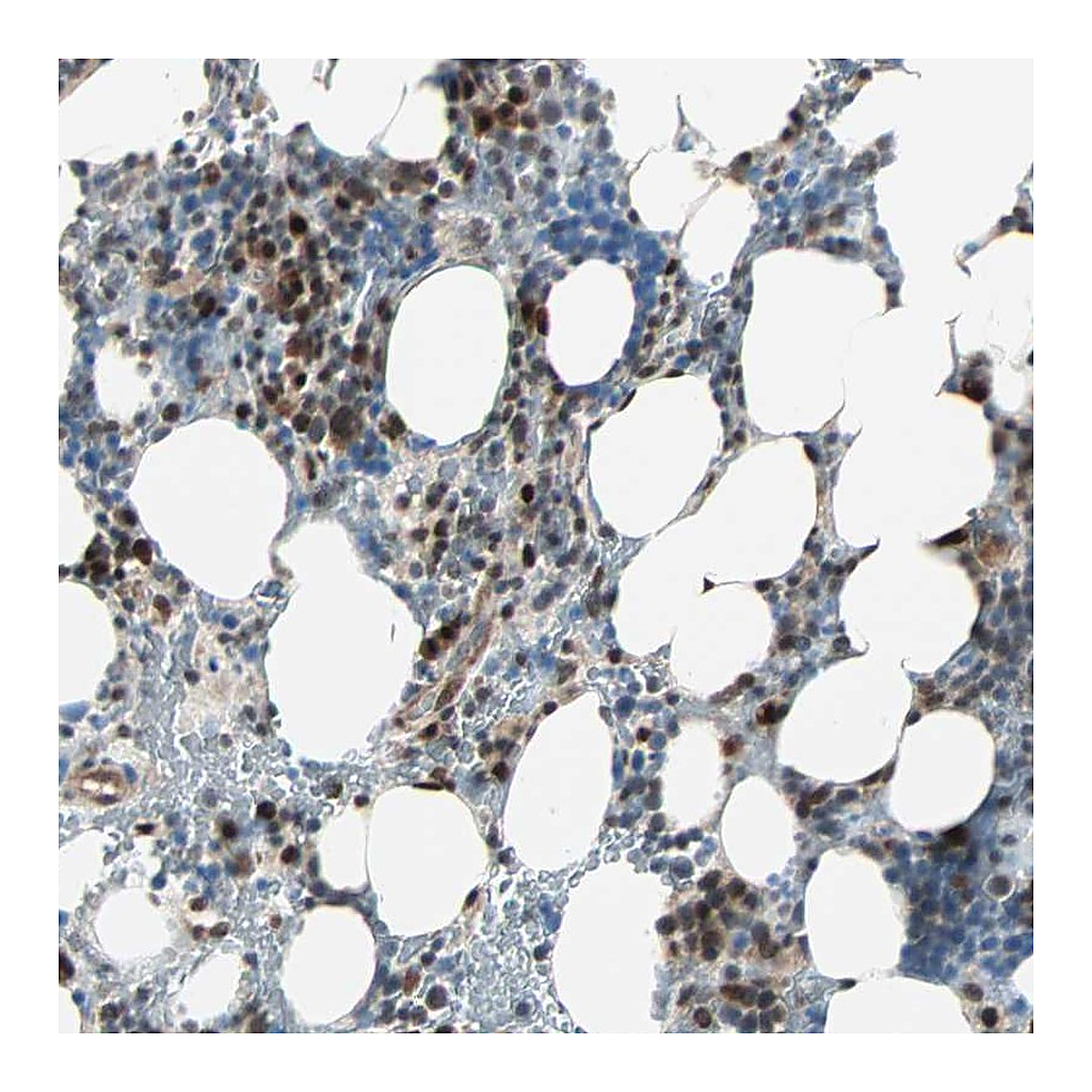 Atlas Antibodies Anti-CBX4 Antibody