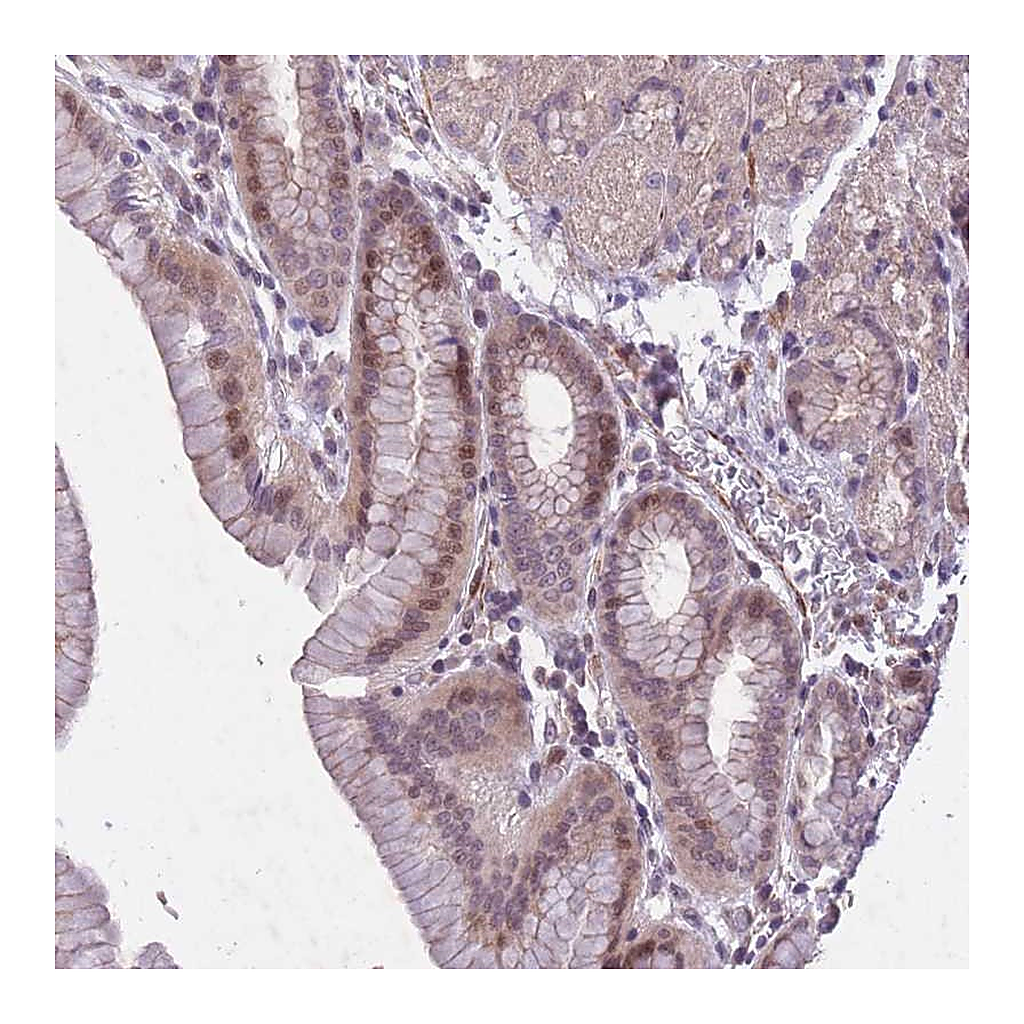 Atlas Antibodies Anti-CBX6 Antibody