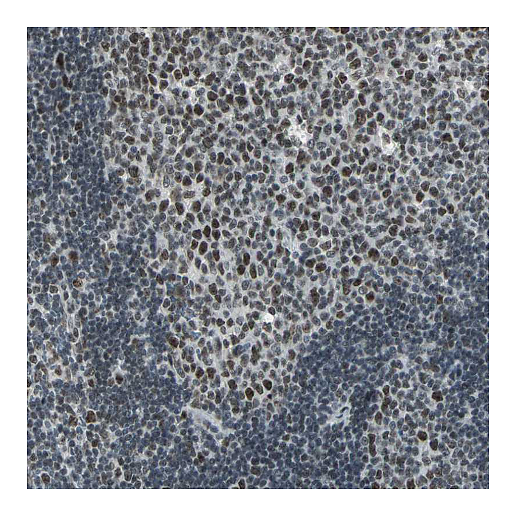 Atlas Antibodies Anti-CBX3 Antibody