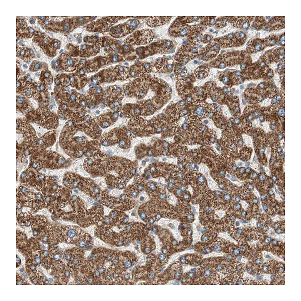 Atlas Antibodies Anti-CC2D1A Antibody