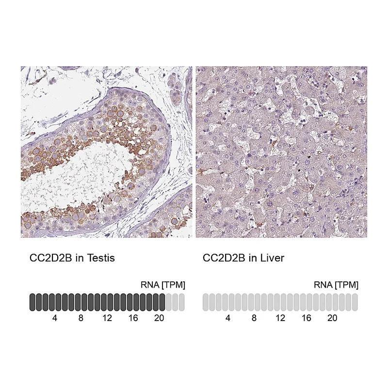 Atlas Antibodies Anti-CC2D2B Antibody