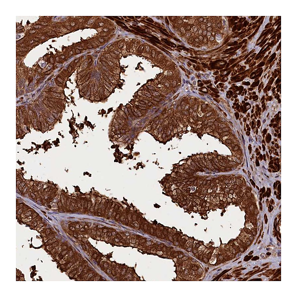 Atlas Antibodies Anti-CCDC102A Antibody