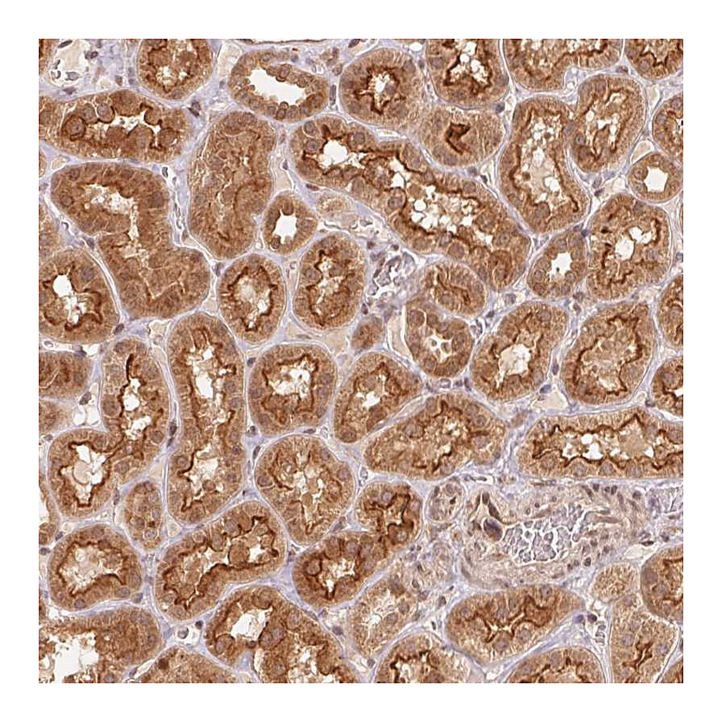 Atlas Antibodies Anti-CCDC102B Antibody