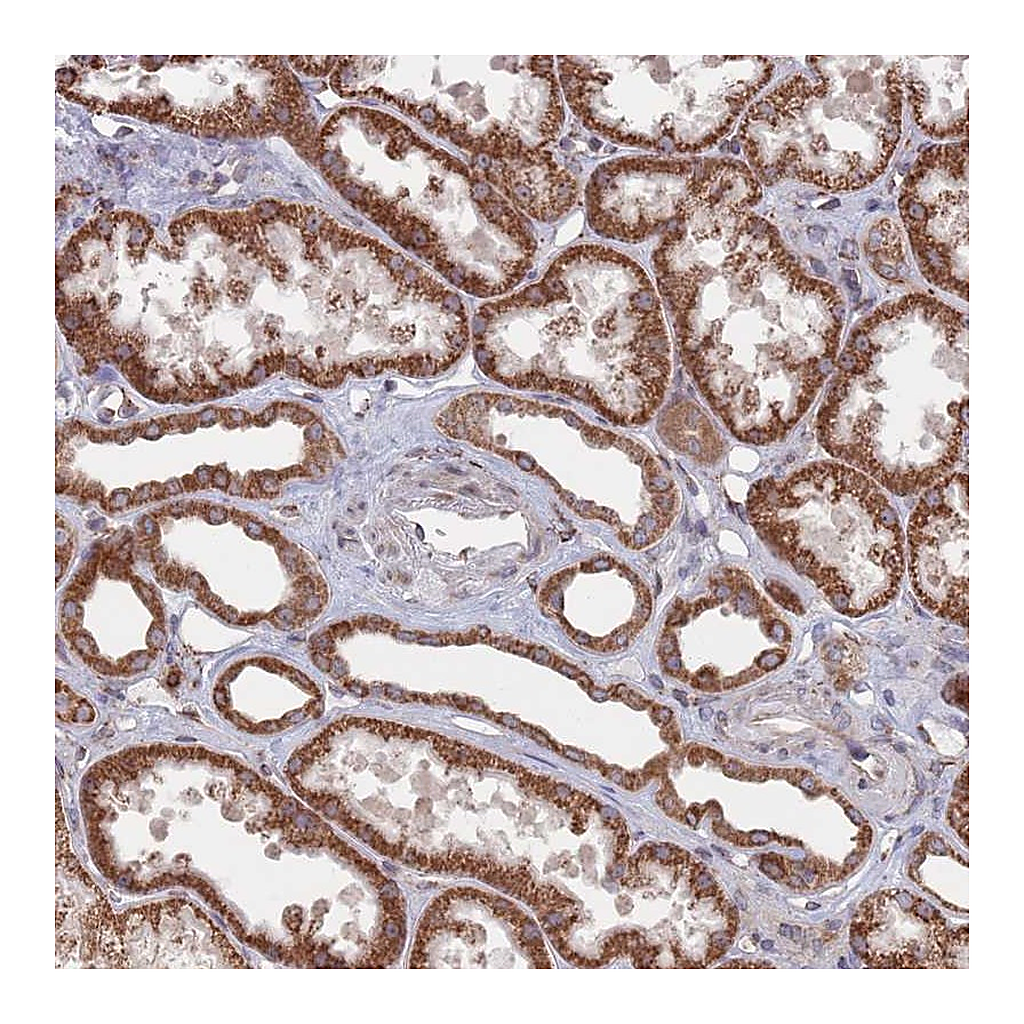 Atlas Antibodies Anti-CCDC106 Antibody