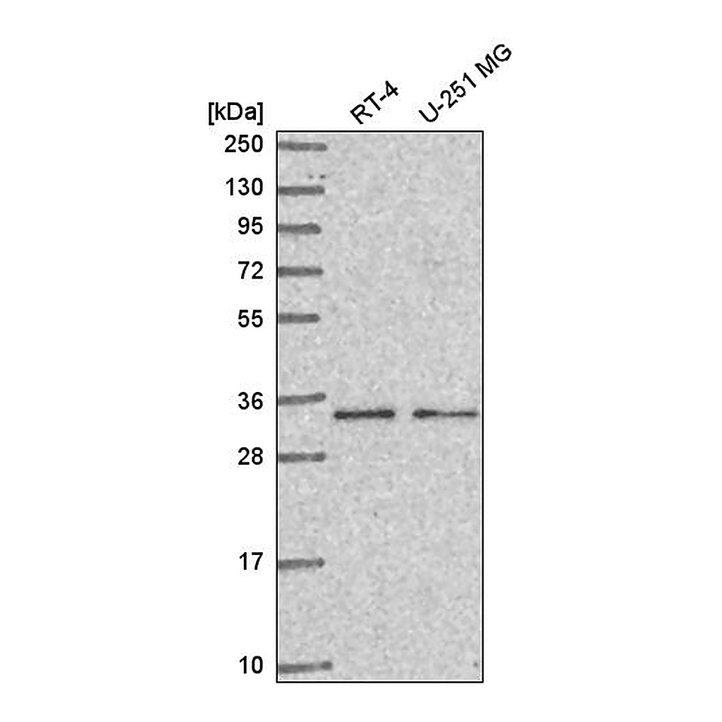 Atlas Antibodies Anti-CCDC107 Antibody
