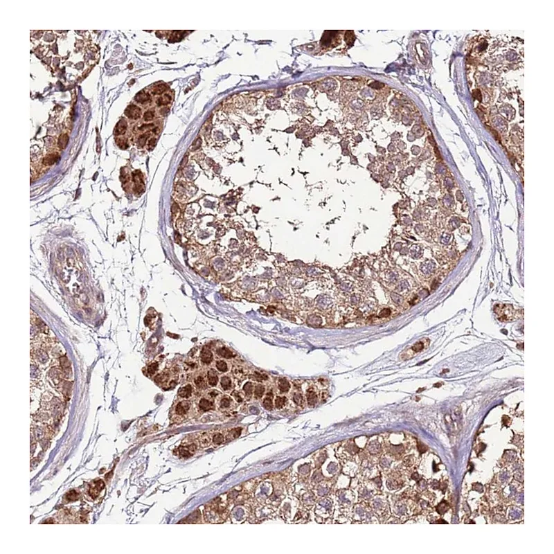 Atlas Antibodies Anti-CCDC112 Antibody