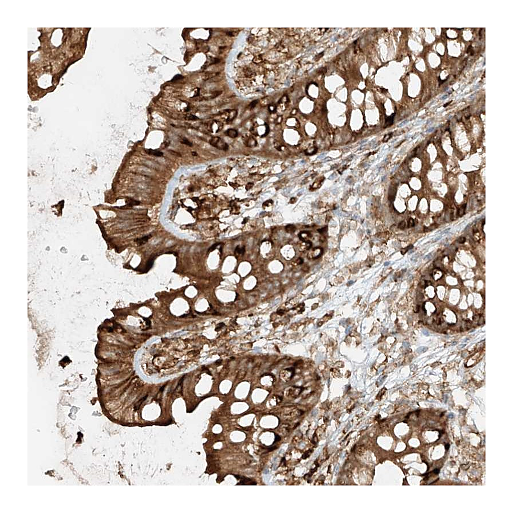 Atlas Antibodies Anti-CCDC115 Antibody