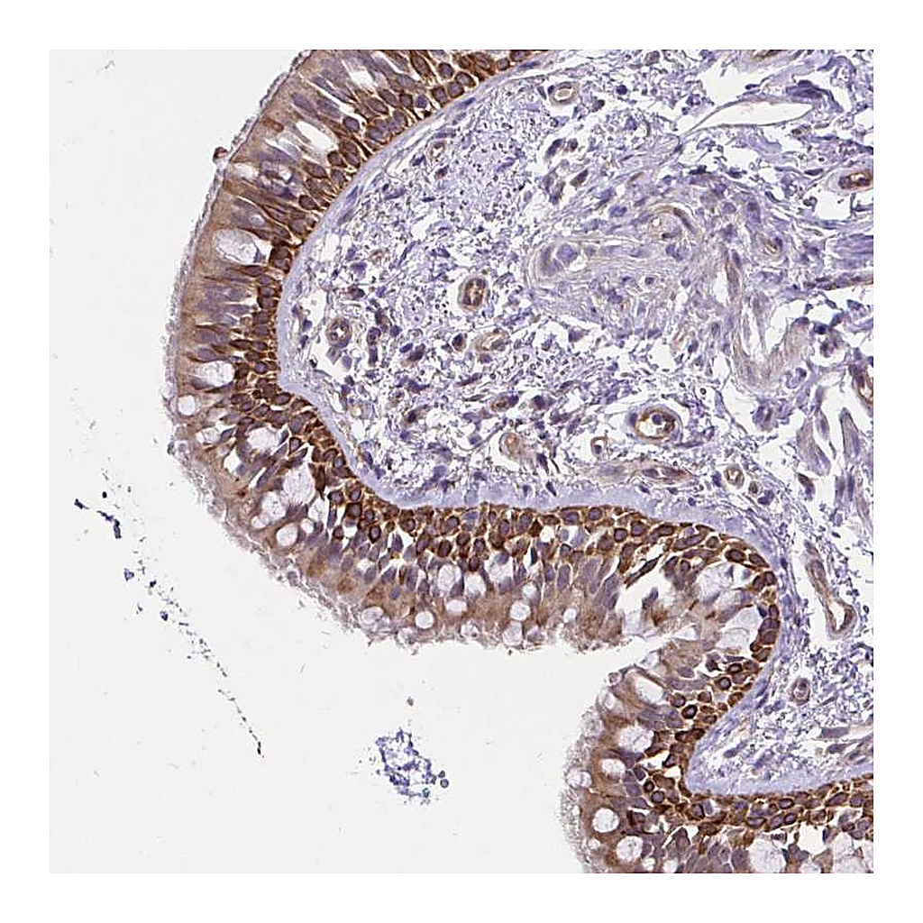 Atlas Antibodies Anti-CCDC122 Antibody
