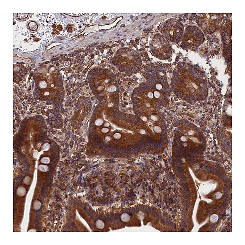 Atlas Antibodies Anti-CCDC124 Antibody