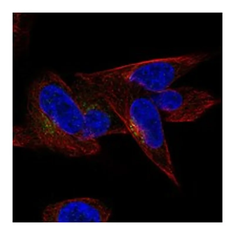 Atlas Antibodies Anti-CCDC126 Antibody