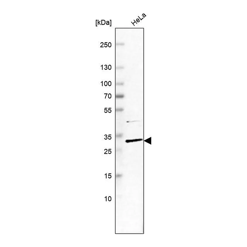 Atlas Antibodies Anti-CCDC127 Antibody