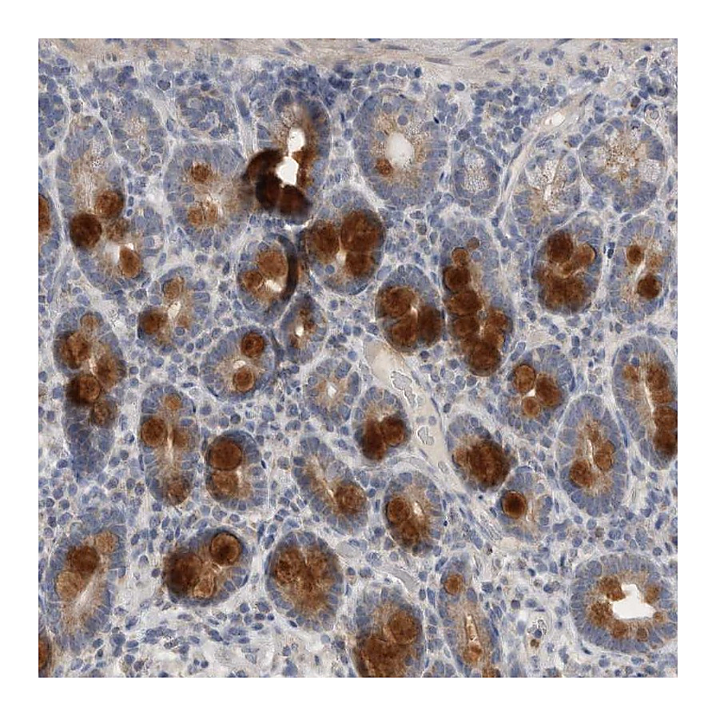Atlas Antibodies Anti-CCDC126 Antibody