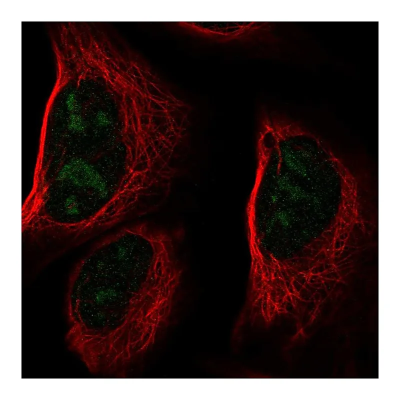 Atlas Antibodies Anti-CCDC137 Antibody