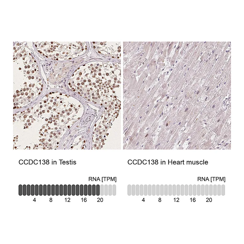 Atlas Antibodies Anti-CCDC138 Antibody