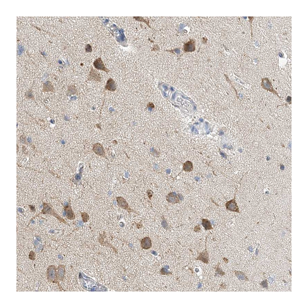 Atlas Antibodies Anti-CCDC14 Antibody