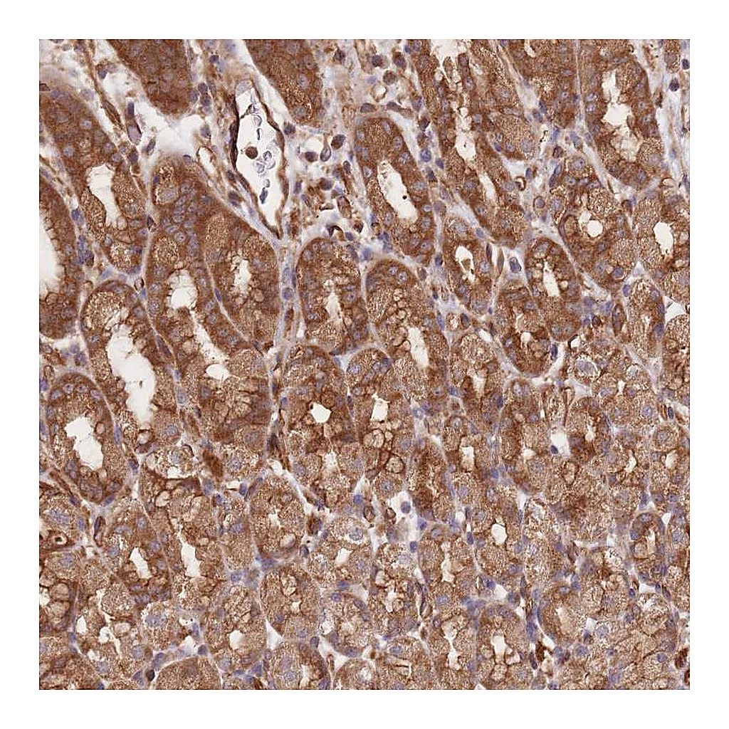 Atlas Antibodies Anti-CCDC140 Antibody