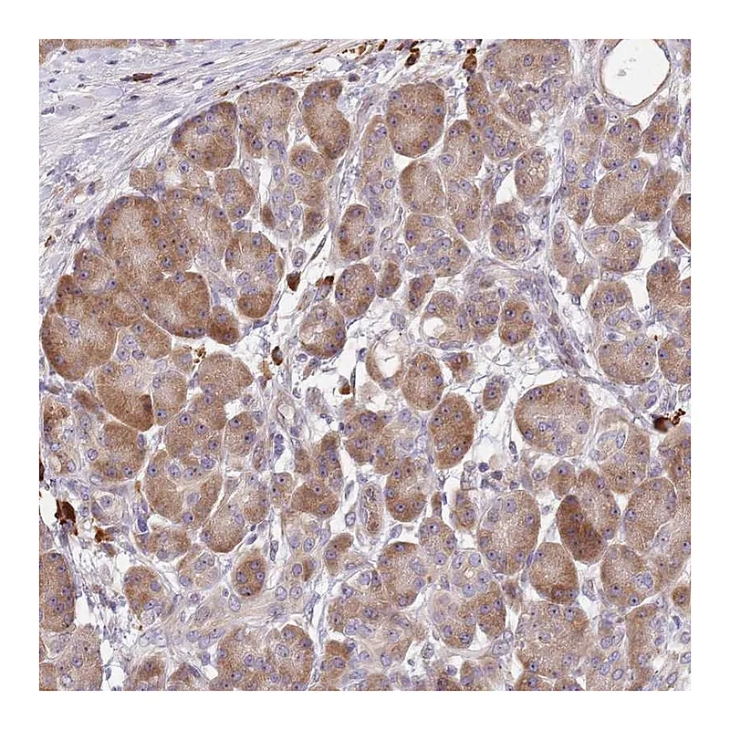 Atlas Antibodies Anti-CCDC140 Antibody