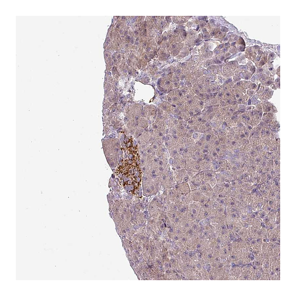 Atlas Antibodies Anti-CCDC144A Antibody