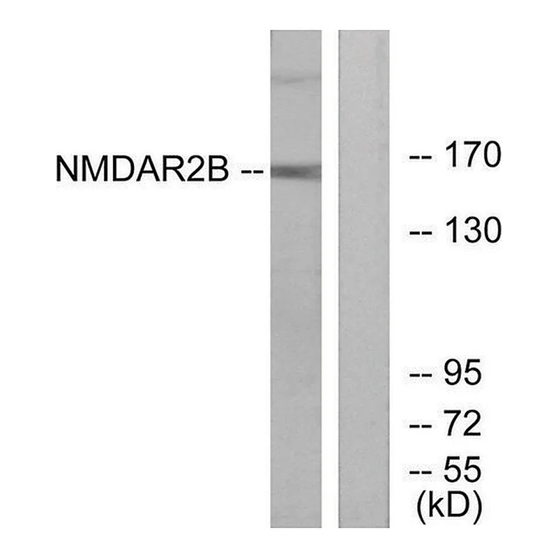 Merck Anti-NMDAR2B antibody produced in rabbit