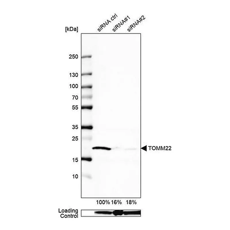 Merck Anti-TOMM22 antibody produced in rabbit