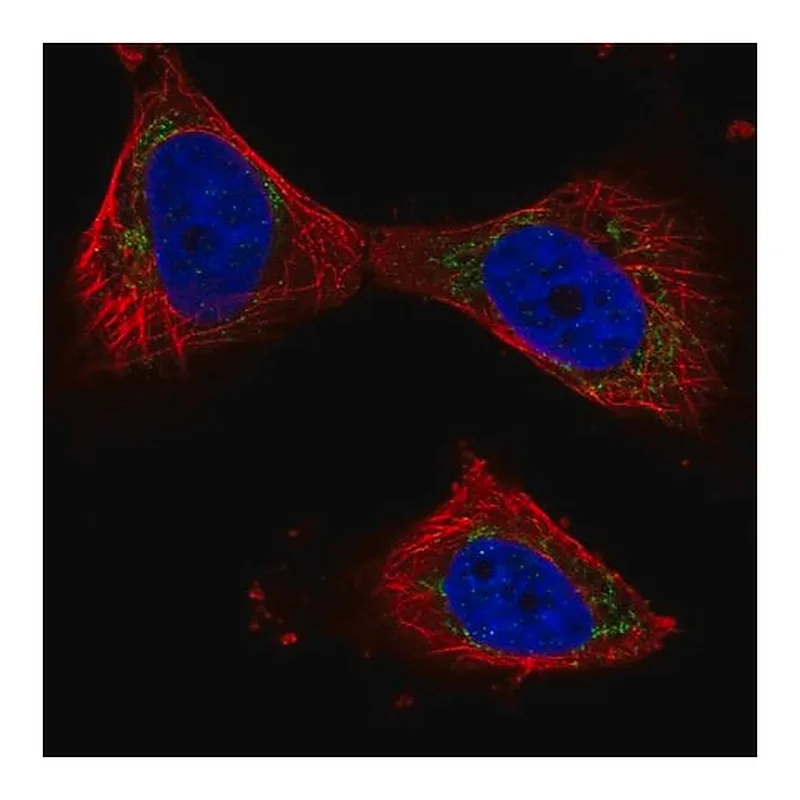 Merck Anti-PPP3CB antibody produced in rabbit