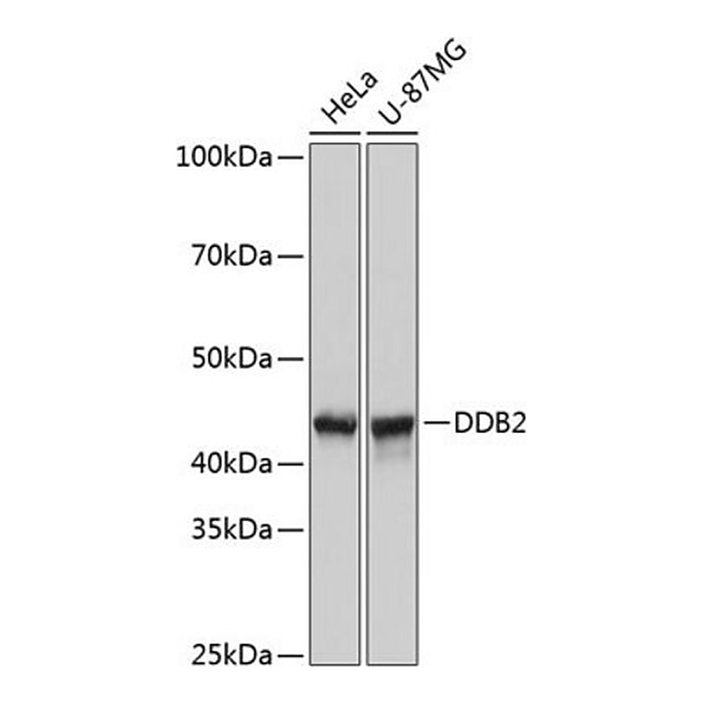 Merck Anti-DDB2 antibody produced in rabbit