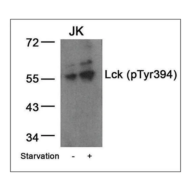 Merck Anti-phospho-LCK (pTyr394) antibody produced in rabbit