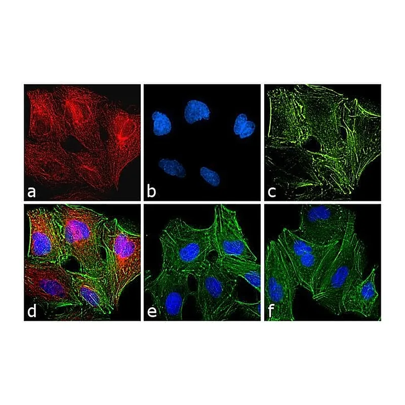 Thermo Fisher Scientific Chicken anti-Rat IgG (H+L) Cross-Adsorbed Secondary Antibody, Alexa Fluor 594