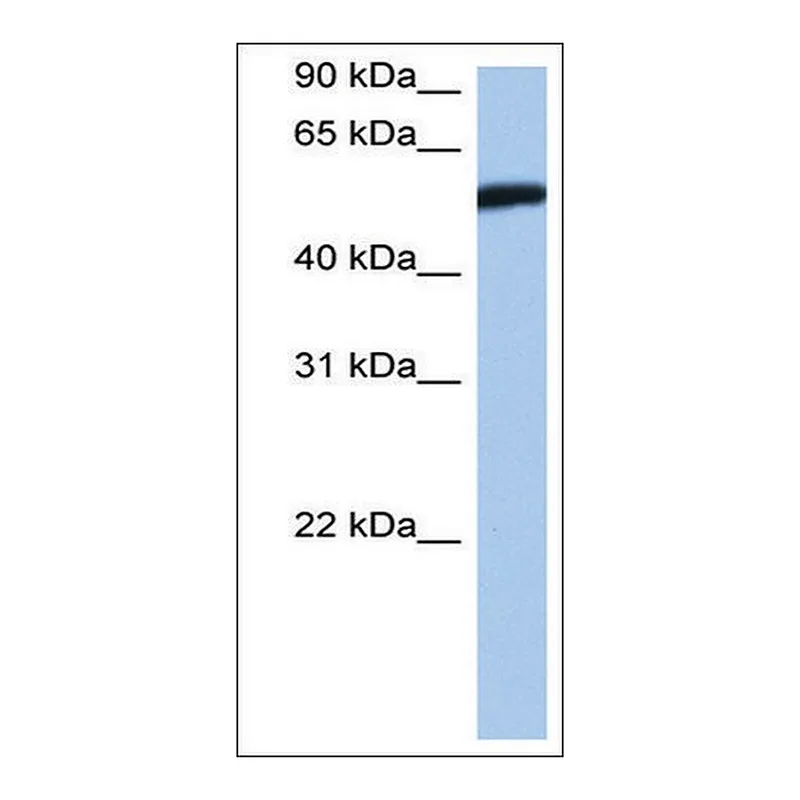Merck Anti-HMG20A (AB2) antibody produced in rabbit