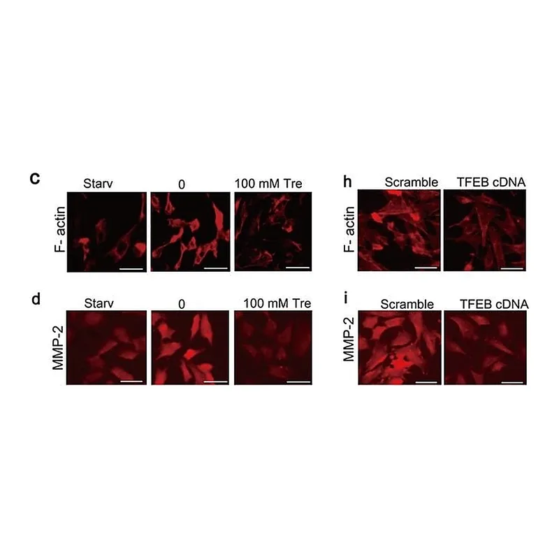 Thermo Fisher Scientific Donkey anti-Mouse IgG (H+L) Highly Cross-Adsorbed Secondary Antibody, Alexa Fluor 555