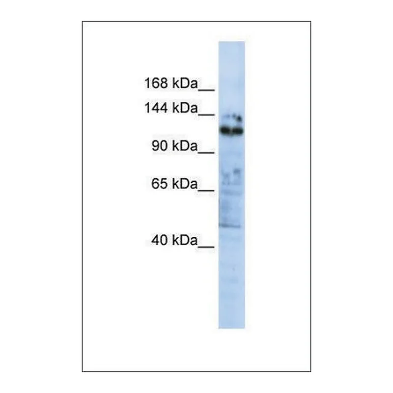 Merck Anti-ZNF451