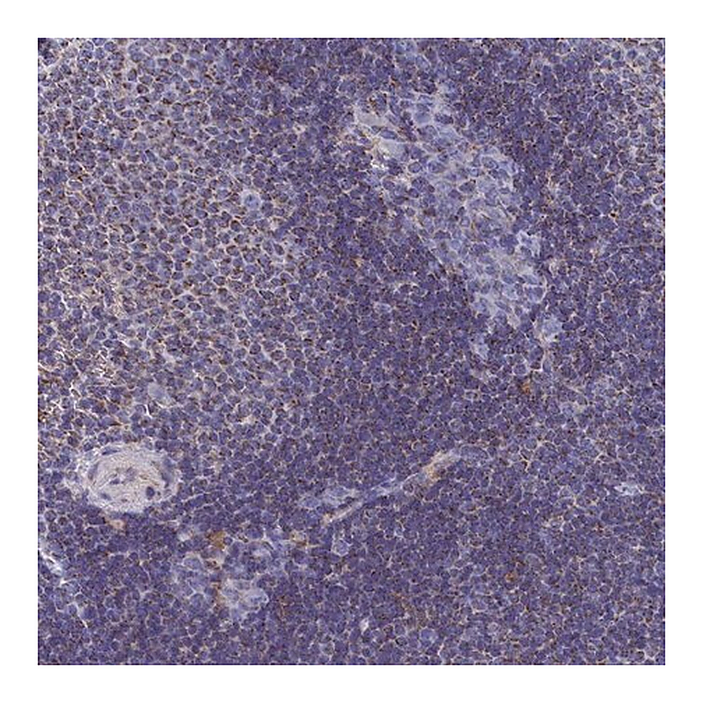 Merck Anti-CCRL2 antibody produced in rabbit