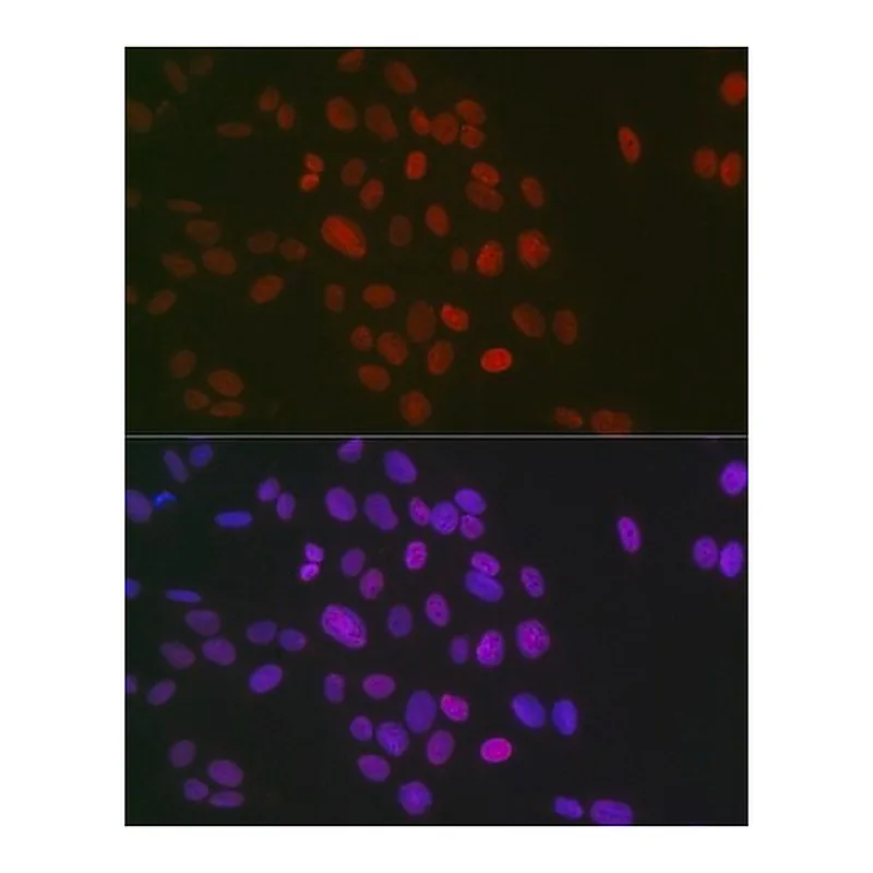 Merck Anti-Symmetric DiMethyl-Histone H3-R26 antibody produced in rabbit