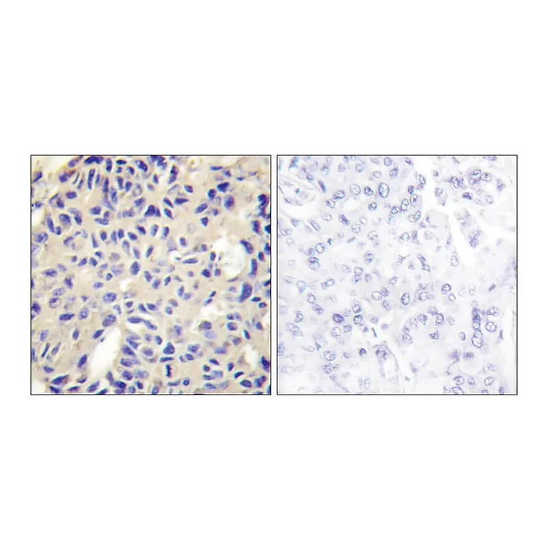 Merck Anti-Collagen V alpha2 antibody produced in rabbit
