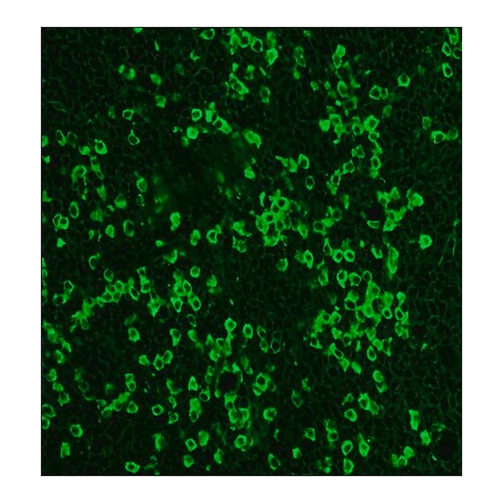 Merck Anti-Rabbit IgG (whole molecule)-FITC antibody produced in sheep