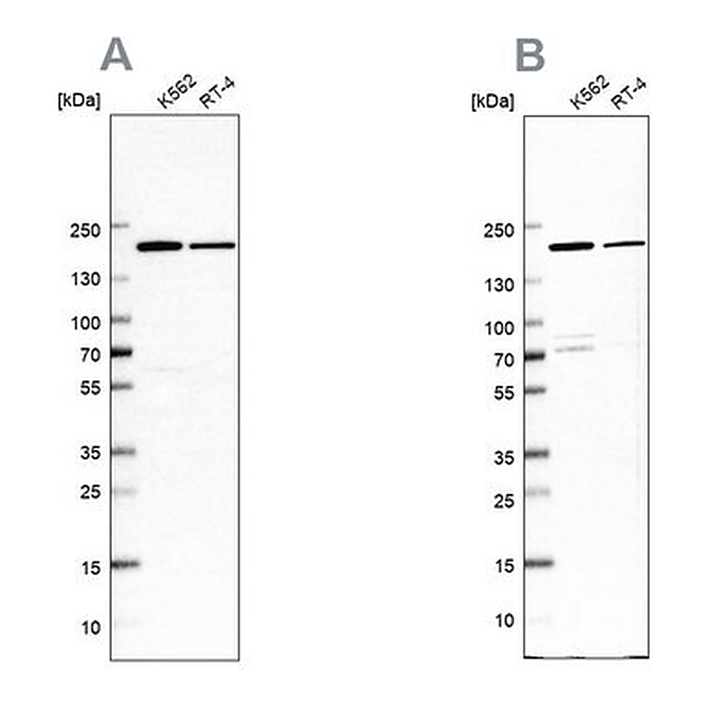Merck Anti-EPRS antibody produced in rabbit