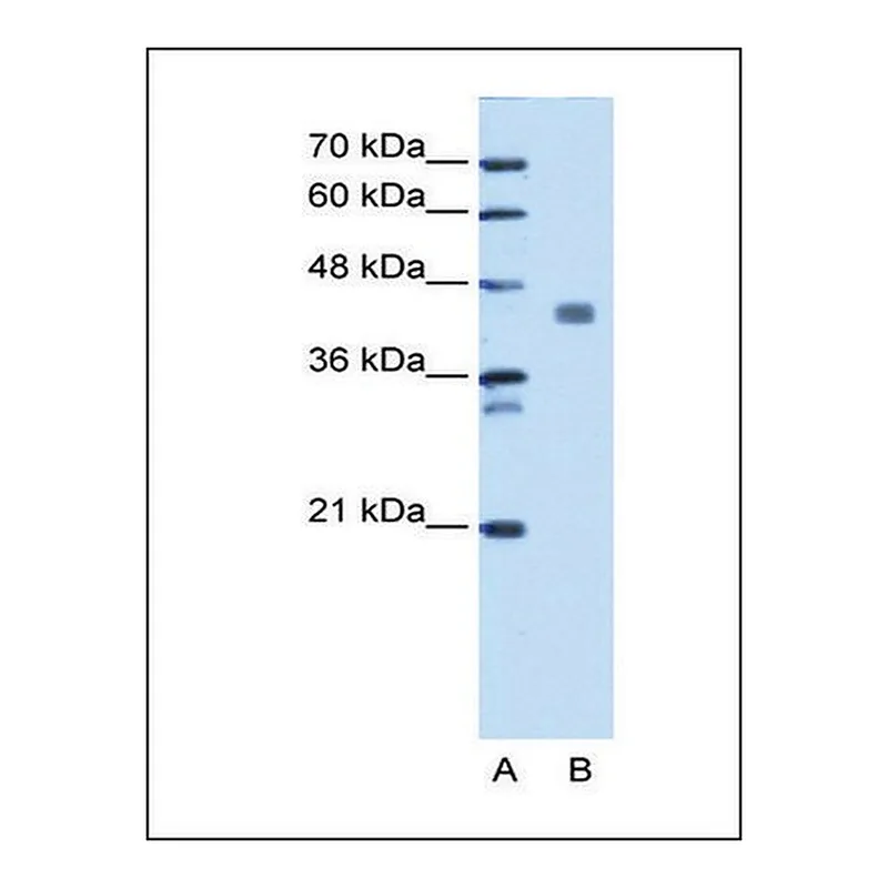 Merck Anti-PDHA1 (AB2) antibody produced in rabbit
