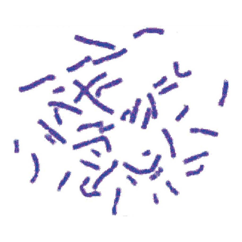 Himedia Giemsa Stain Solution