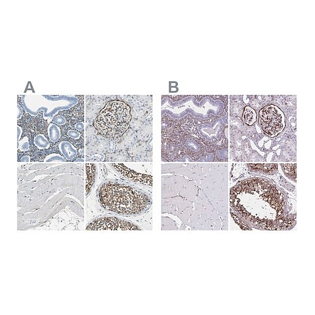 Merck Anti-AKAP12 antibody produced in rabbit