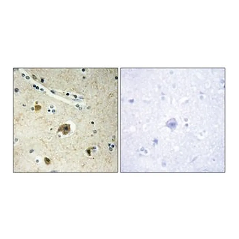 Merck ANTI-COLLAGEN IV ALPHA4