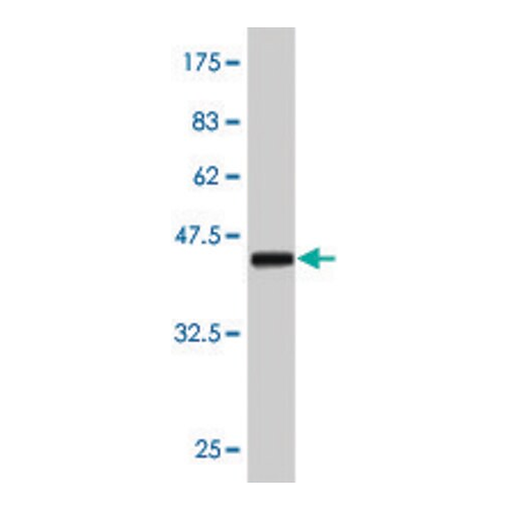 Merck Monoclonal Anti-ERBB2 antibody produced in mouse